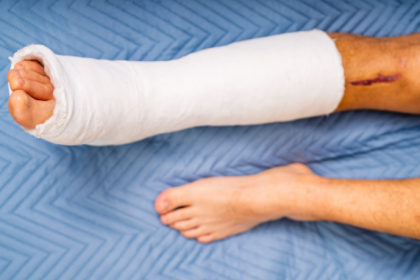 Evitar lesiones en deportes es posible con planificación, según Felipe Schroeder dos Anjos, que ofrece estrategias clave.