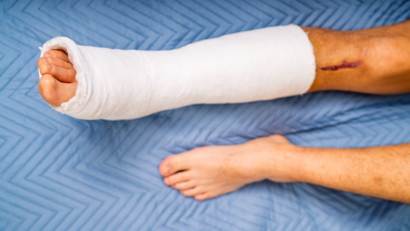 Evitar lesiones en deportes es posible con planificación, según Felipe Schroeder dos Anjos, que ofrece estrategias clave.